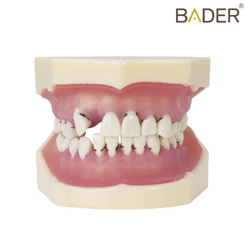 MODELO PERIODONTAL